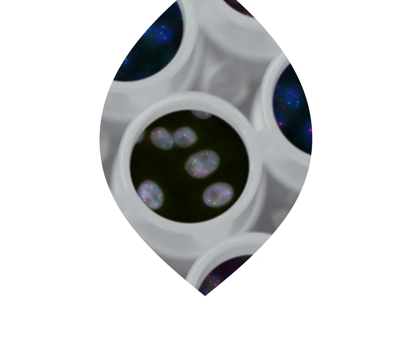 PATH - Patients' Tumorbank of Hope - Brustkrebsfoschung und Biobank für Tumorgewebe